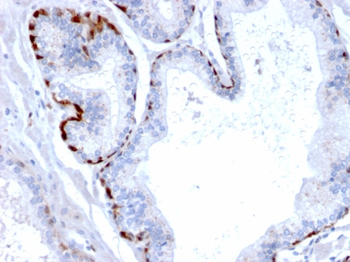 CSTA Antibody
