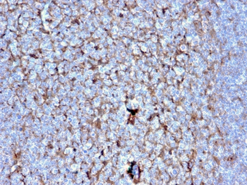 CSTA Antibody