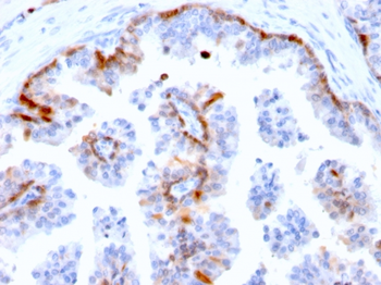 CSTA Antibody