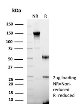 CSTA Antibody