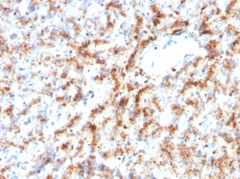 CTSD Antibody