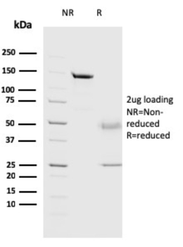 CTSD Antibody