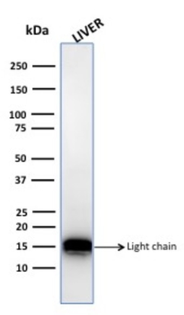 CTSD Antibody