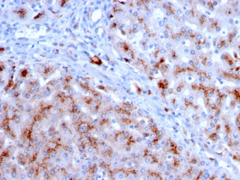 CTSD Antibody