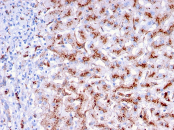 CTSD Antibody