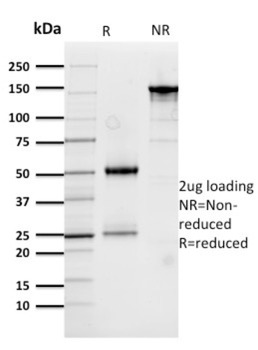 CTSD Antibody