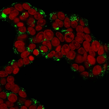 CTSD Antibody