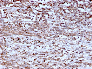 CTSK Antibody