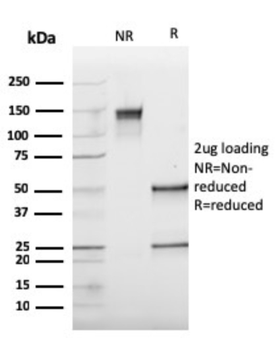 CTSK Antibody