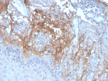 DCN Antibody