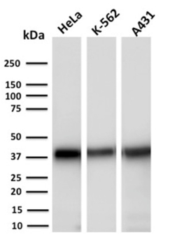 AKR1C2 Antibody