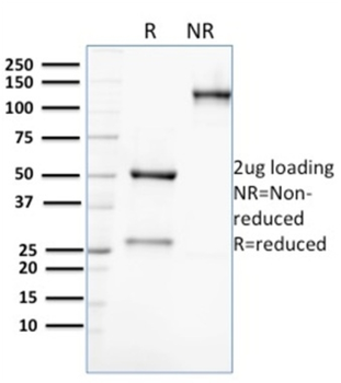 AKR1C2 Antibody