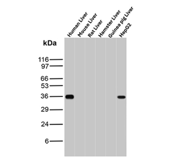 AKR1C2 Antibody