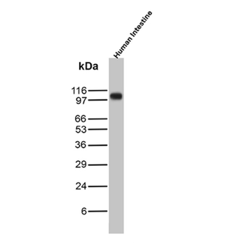 DSC2 Antibody
