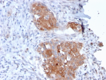 DSG1 Antibody