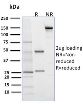 DSG1 Antibody