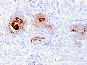 Recombinant TAG-72 / CA72.4 (Tumor-Associated Glycoprotein) Antibody