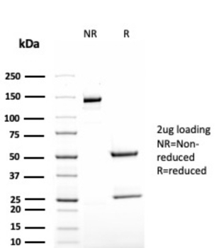 Recombinant TAG-72 / CA72.4 (Tumor-Associated Glycoprotein) Antibody