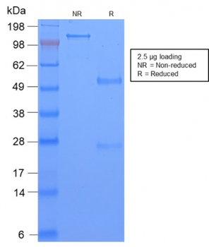 Recombinant TAG-72 / CA72.4 (Tumor-Associated Glycoprotein) Antibody
