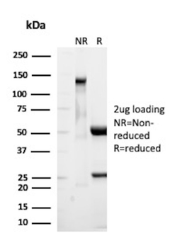 Recombinant TAG-72 / CA72.4 (Tumor-Associated Glycoprotein) Antibody