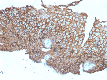 DSG3 Antibody