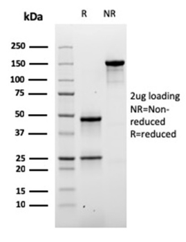 DSG3 Antibody