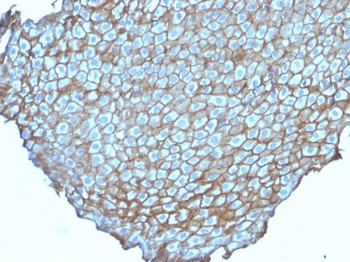 DSG3 Antibody