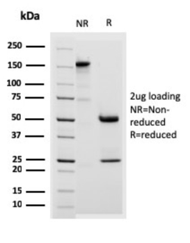 DSG3 Antibody