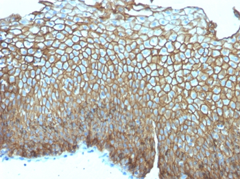 DSG3 Antibody