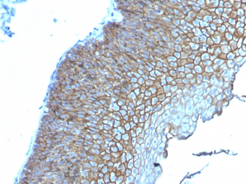 DSG3 Antibody