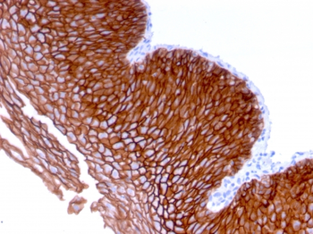 DSG3 Antibody