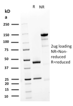 DSG3 Antibody