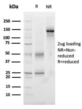 NKX3-1 Antibody