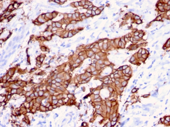 ERBB2 Antibody