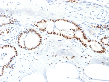 ESR1 Antibody