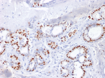 ESR1 Antibody