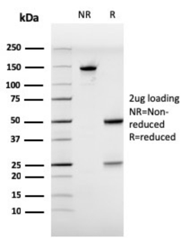 ESR1 Antibody