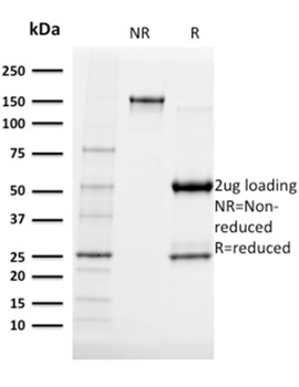 ALB Antibody