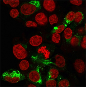 ALB Antibody