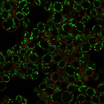EZH2 Antibody