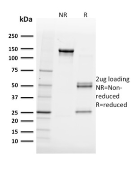 FABP5 Antibody