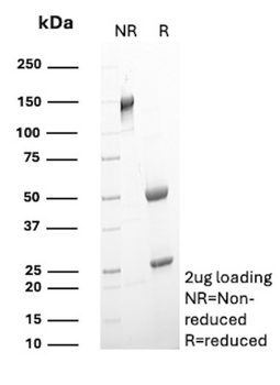 FCGR1A Antibody