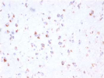 FCGRT Antibody