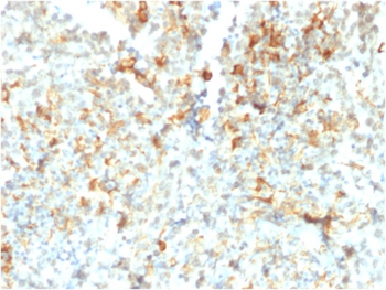 FCGRT Antibody