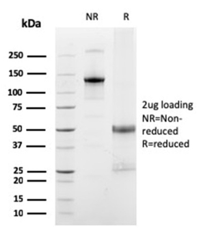 FCGRT Antibody
