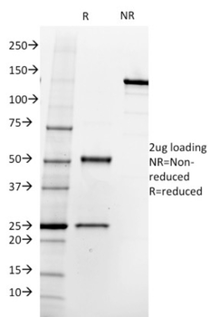 FOLH1 Antibody