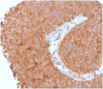 SERBP1 Antibody