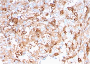 SERBP1 Antibody