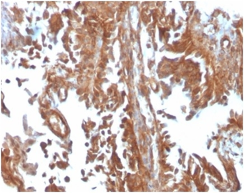 SERBP1 Antibody