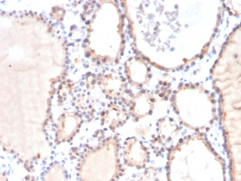 GLO1 Antibody